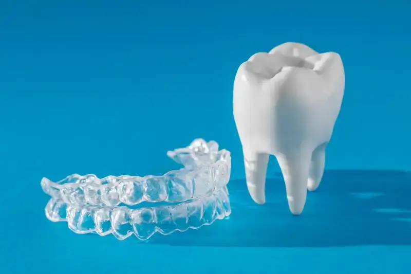 Wszystko co musisz wiedzieć o implantach zębowych