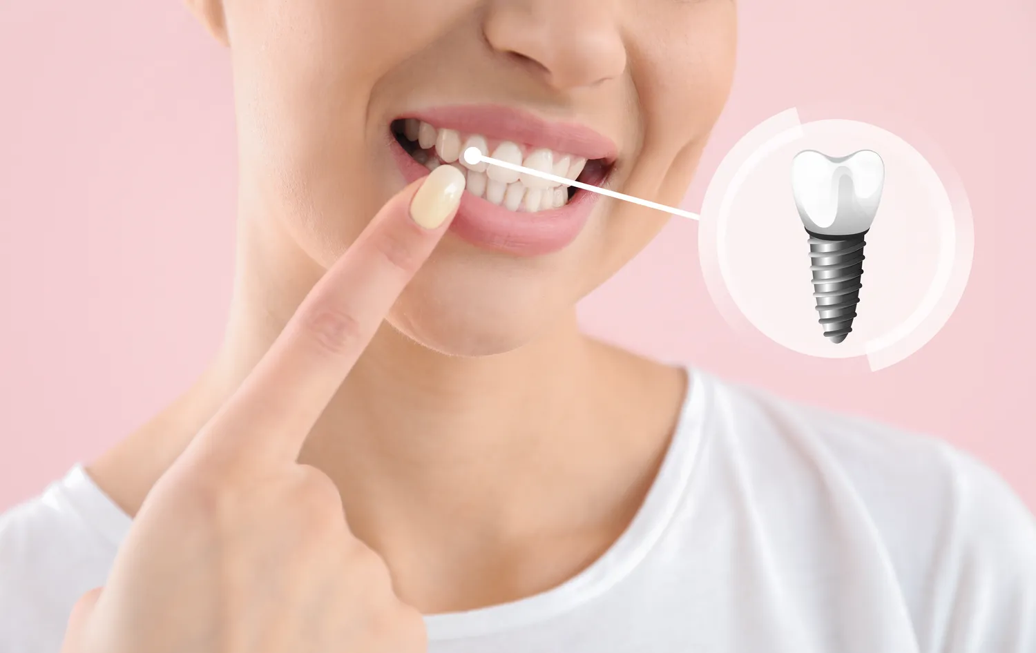 Dentysta - piękny uśmiech, białe zęby