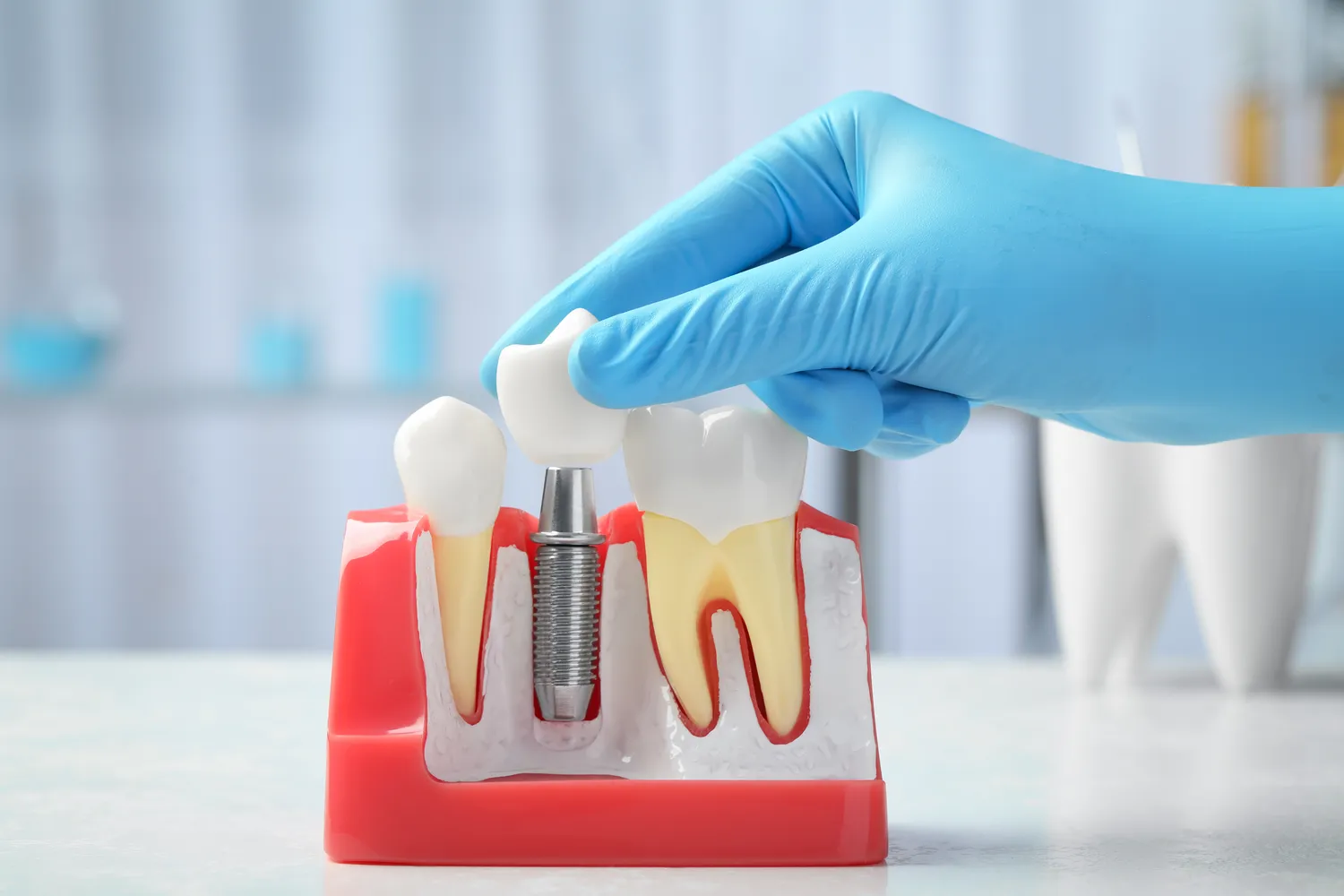 Najlepsza endodoncja Szczecin